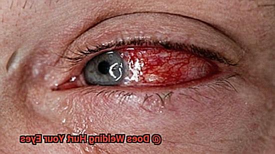 Does Welding Hurt Your Eyes-2